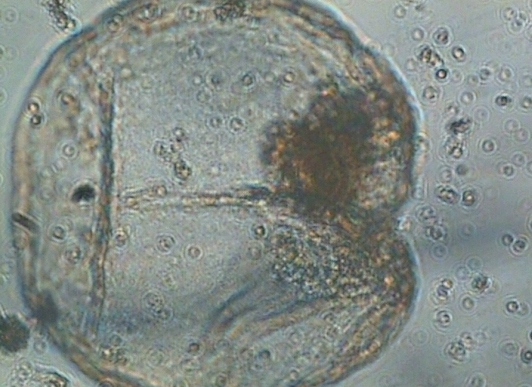 Dictyocha speculum